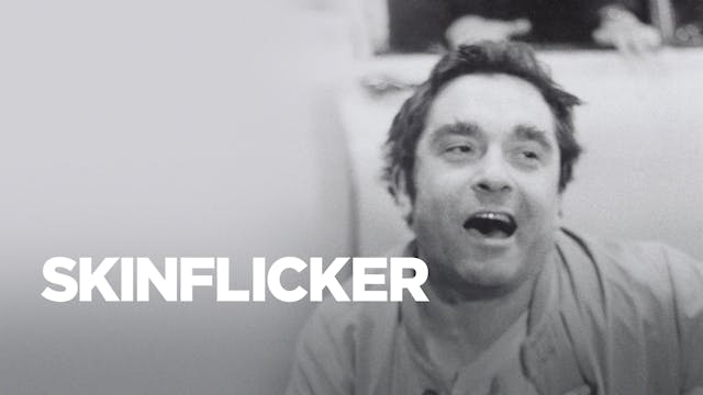 Skinflicker