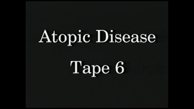 AtopicDiseases_Tape 6