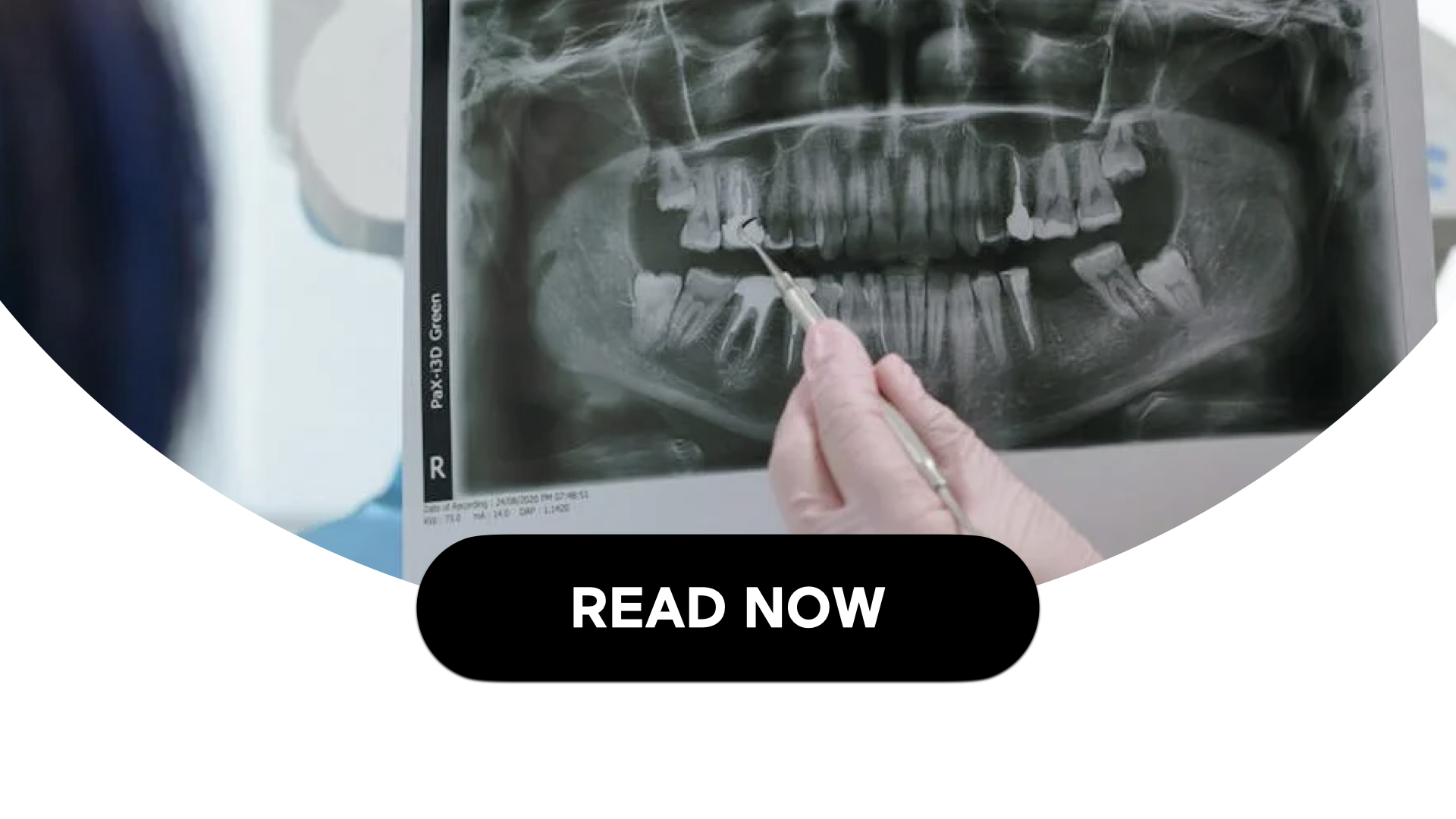 The Complex Link Between Gum Disease & Diabetes (4 Min Read)