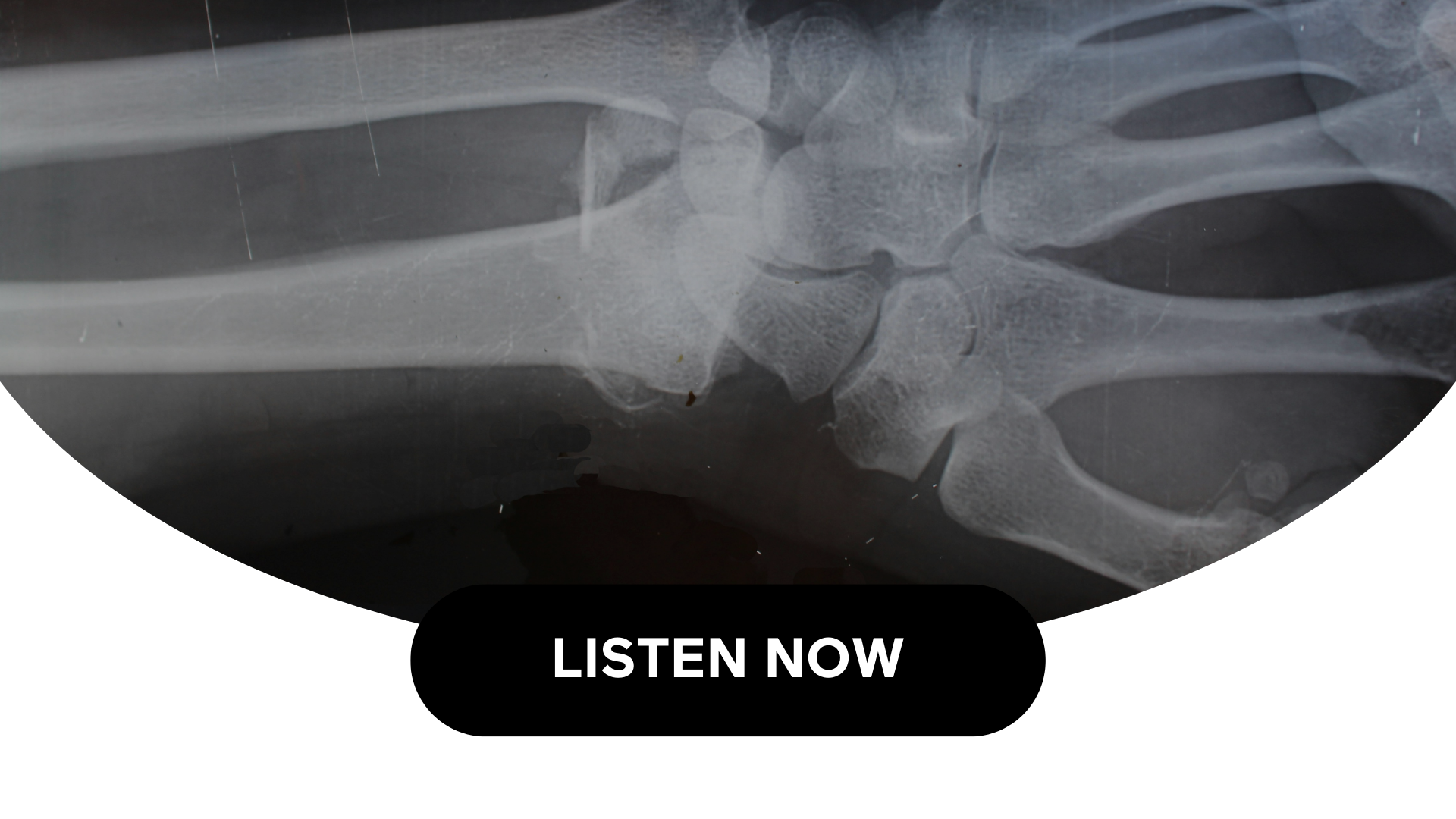 Maintaining Healthy Bones As You Age (Audio)