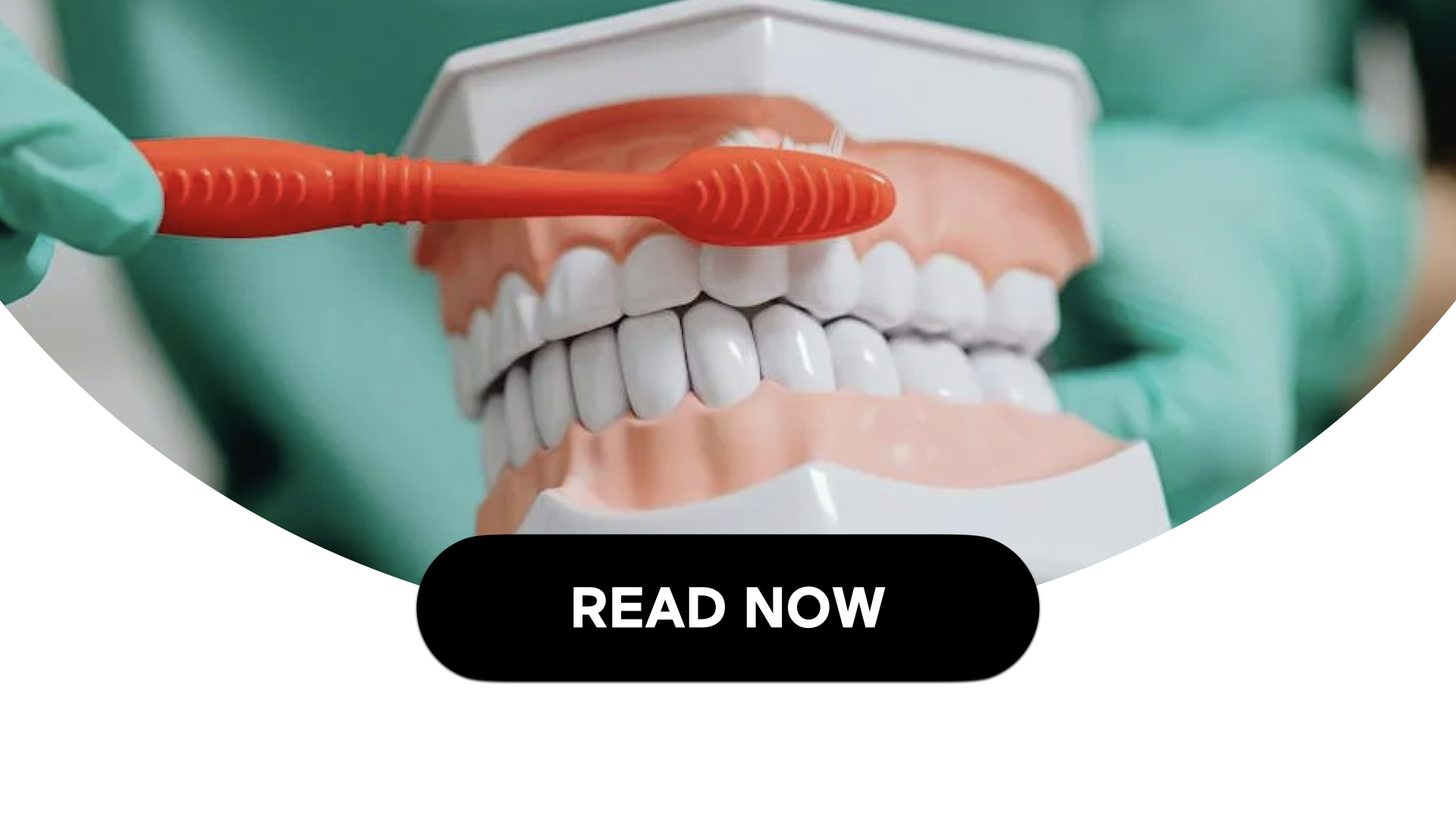 What Are Cavities & How To Prevent Them (4 Min Read)