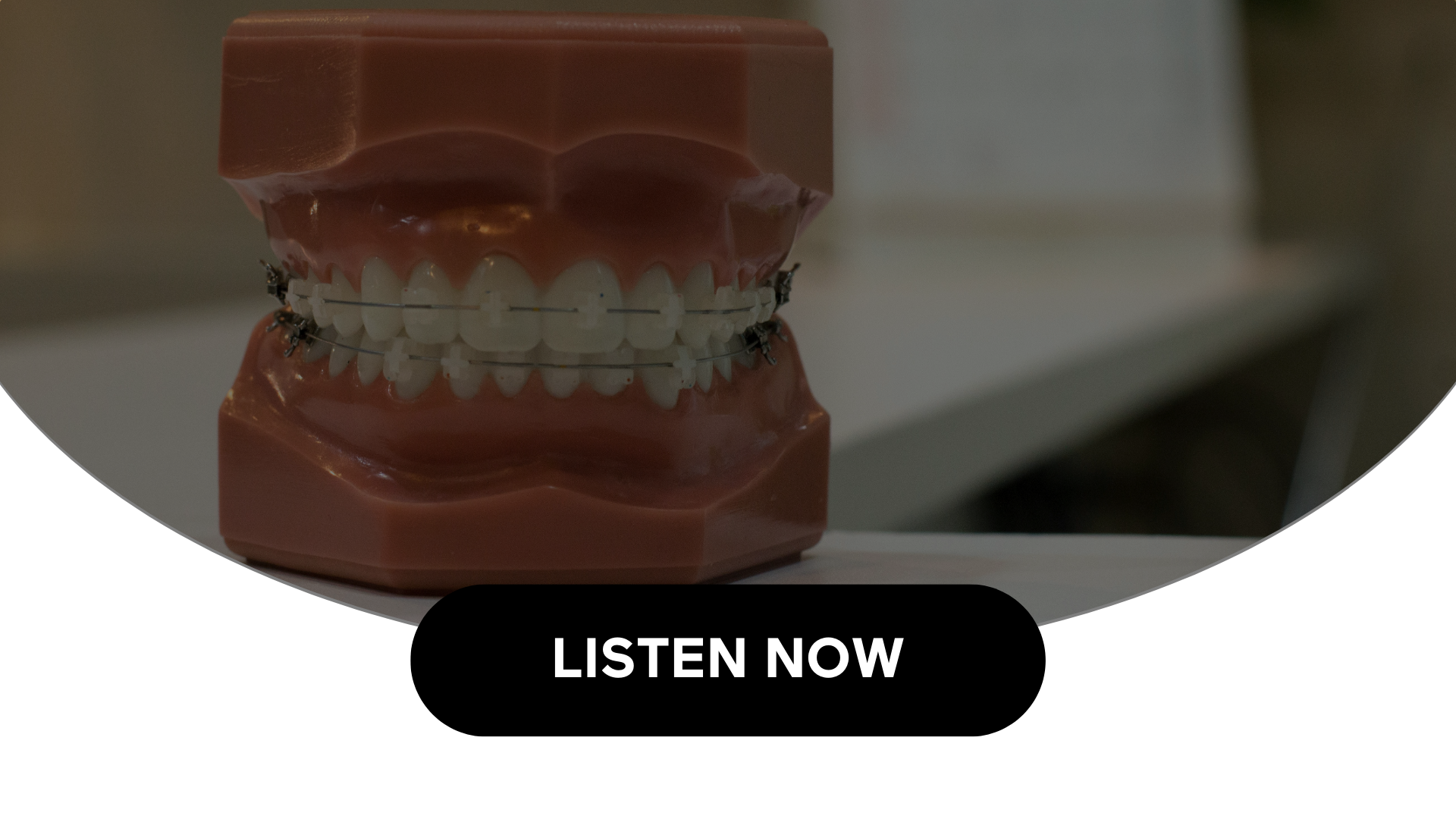 Connections Between Gum Disease & Heart Disease (Audio)