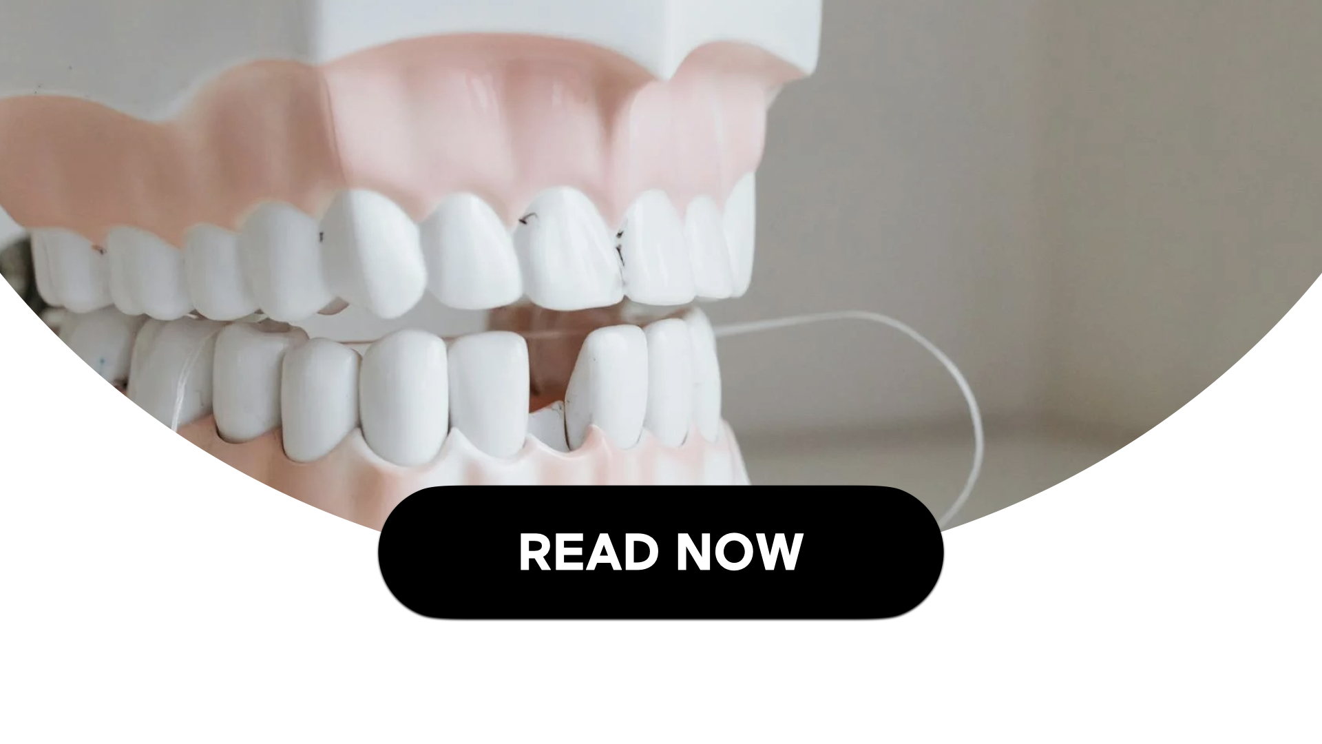 Recognizing Early Gum Disease & Exploring Treatment Options (3 Min Read)