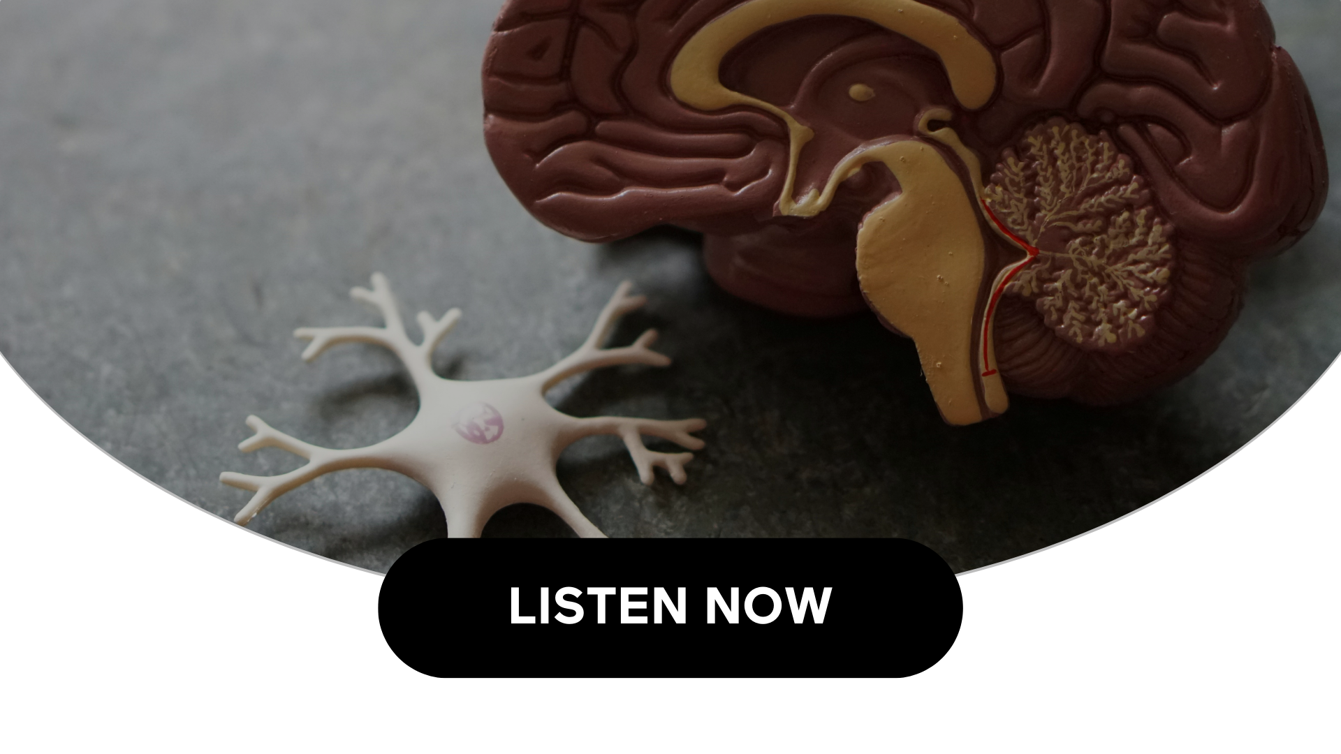 Comparing Dementia & Alzheimers Disease (Audio)