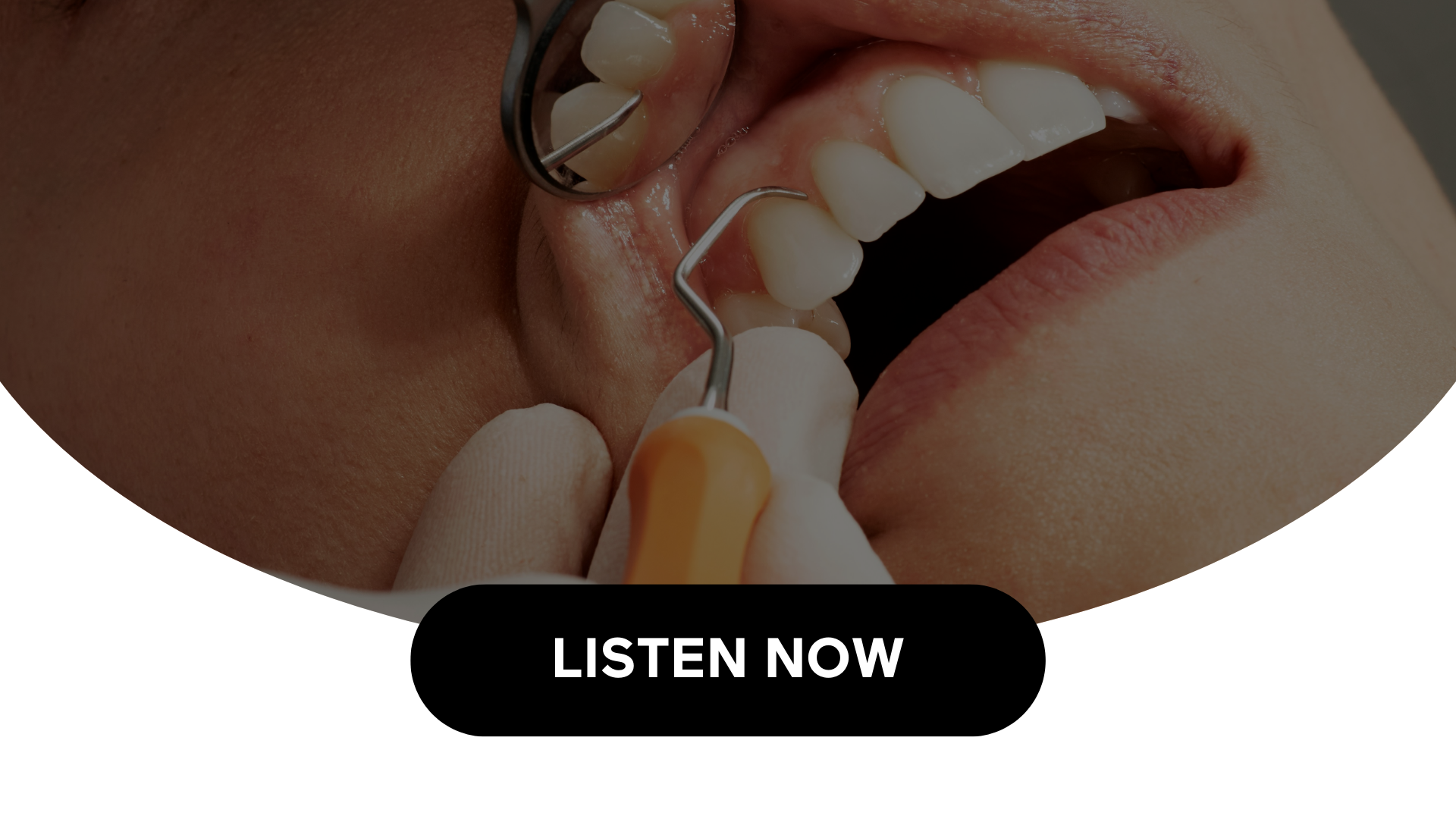 Recognizing Potential Early Indicators Of Oral Cancer (Audio)