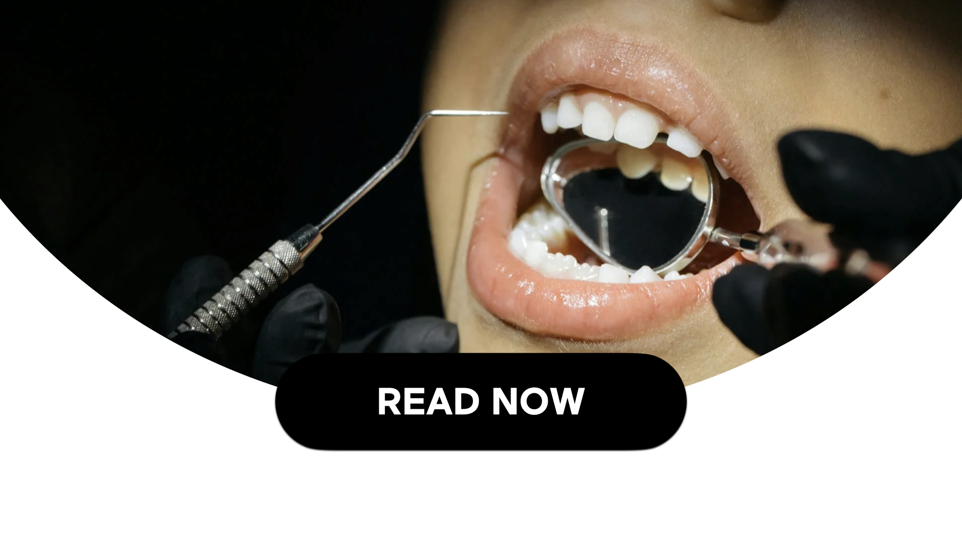 What To Expect During Your Child’s First Dental Visits (4 Min Read)