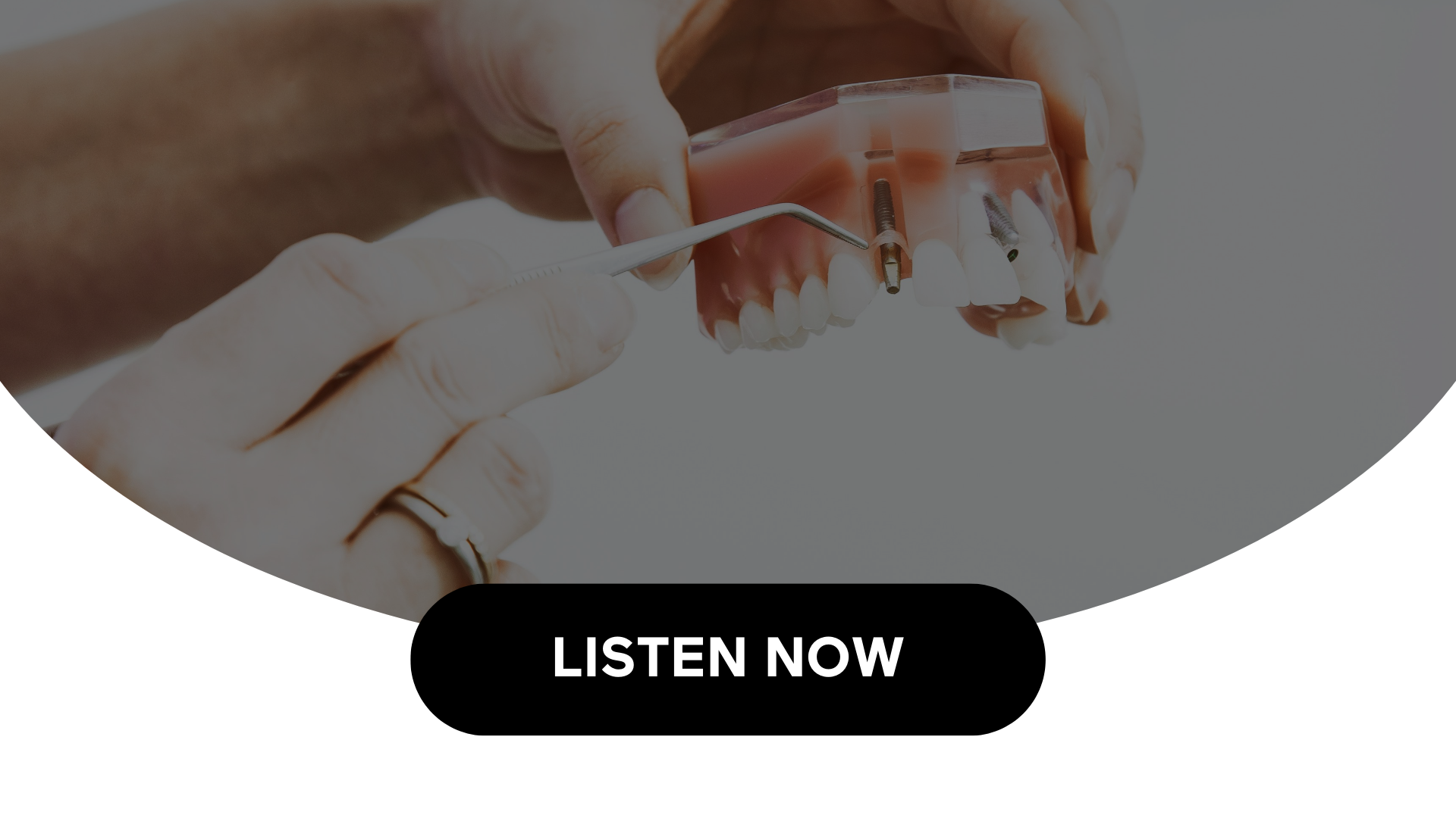 The Link Between Gum Disease & Diabetes (Audio)