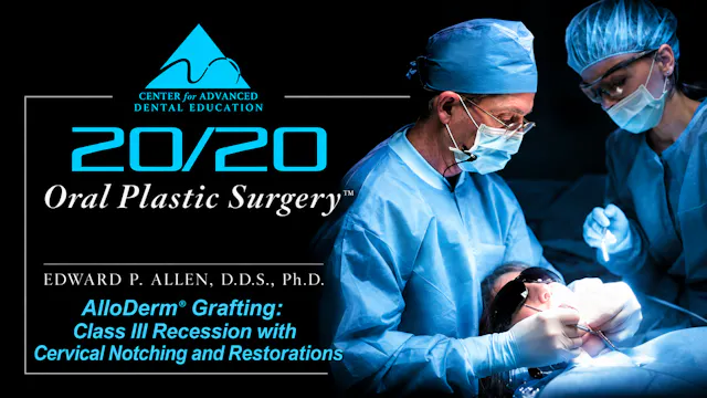 12 LA Deep Recession and Cervical Restorations