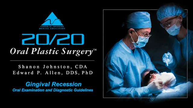 T2 Gingival Recession