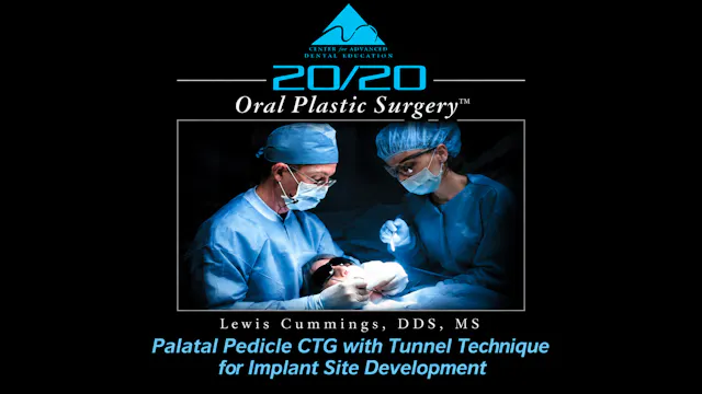 28 Palatal Pedicle CTG for Imp Site Development