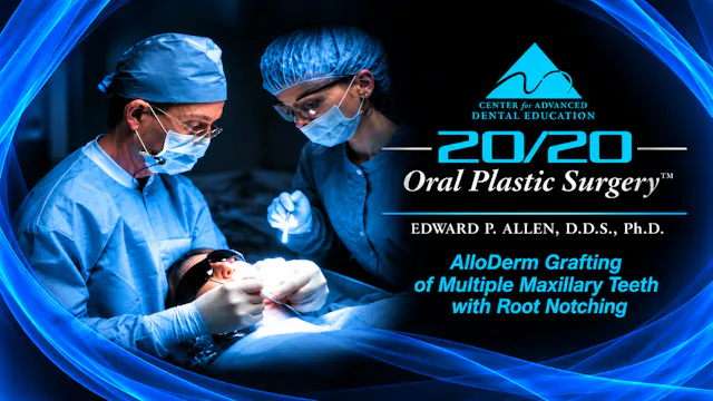 8 ADM Grafting Multiple Maxillary Teeth with NCCLs