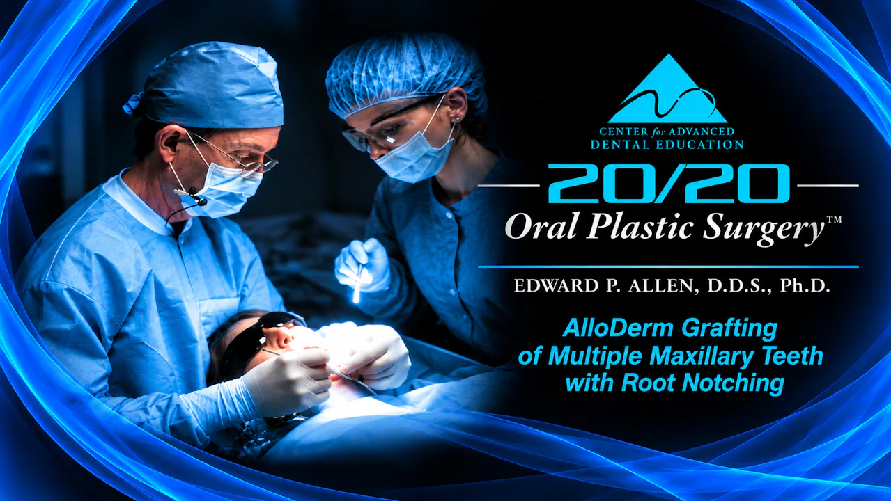 8 ADM Grafting Multiple Maxillary Teeth with NCCLs