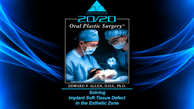 9 Implant Soft Tissue Defect in the Esthetic Zone