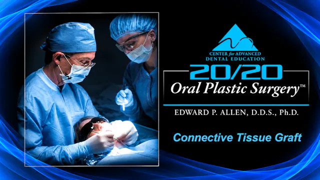 6 Connective Tissue Graft
