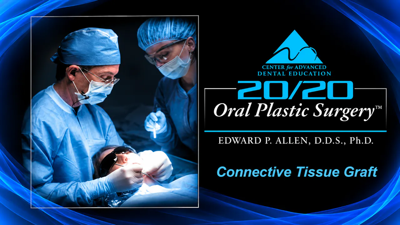 6 Connective Tissue Graft