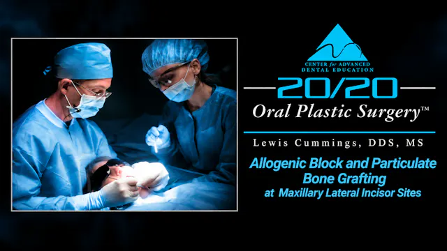 26 Allogenic Block at Max Lateral Incisor Sites