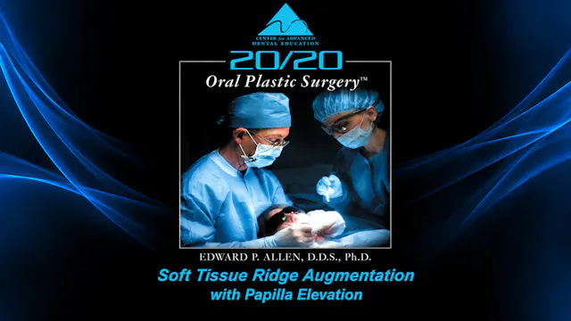 21 Soft Tissue Ridge Aug & Papilla Elevation