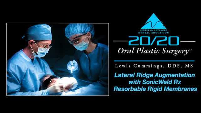 27 Lateral Ridge Augmentation with SonicWeld RX