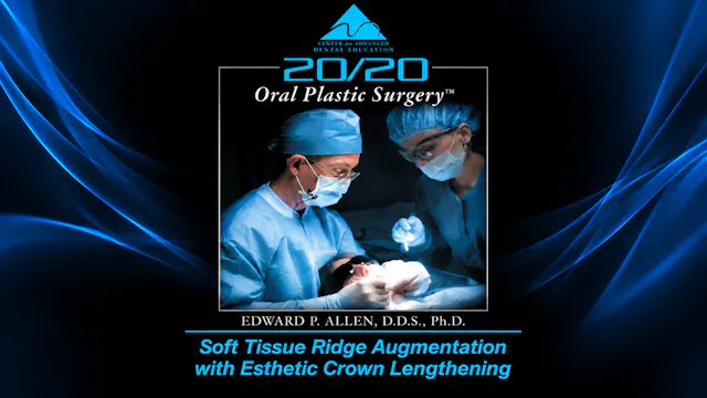 22 Esth Crown Lengthening & Ridge Augmentation