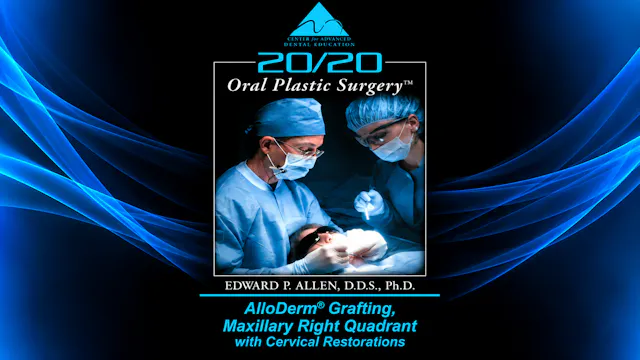 10 ADM for Maxillary Teeth w Cervical Restorations
