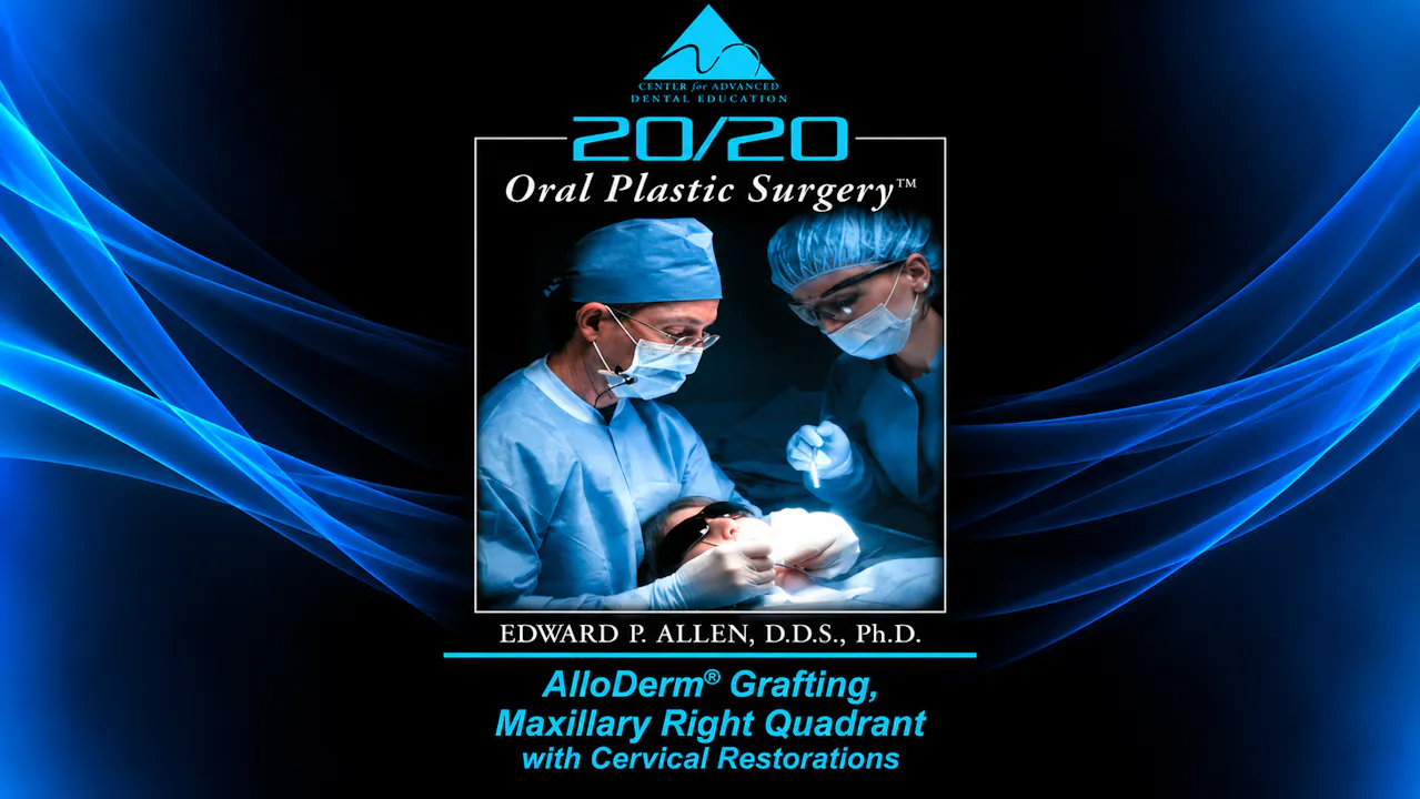 10 ADM for Maxillary Teeth w Cervical Restorations