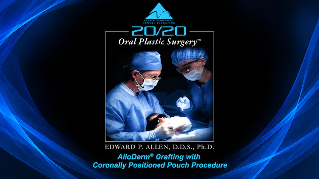 4 Coronally Positioned Pouch Procedure