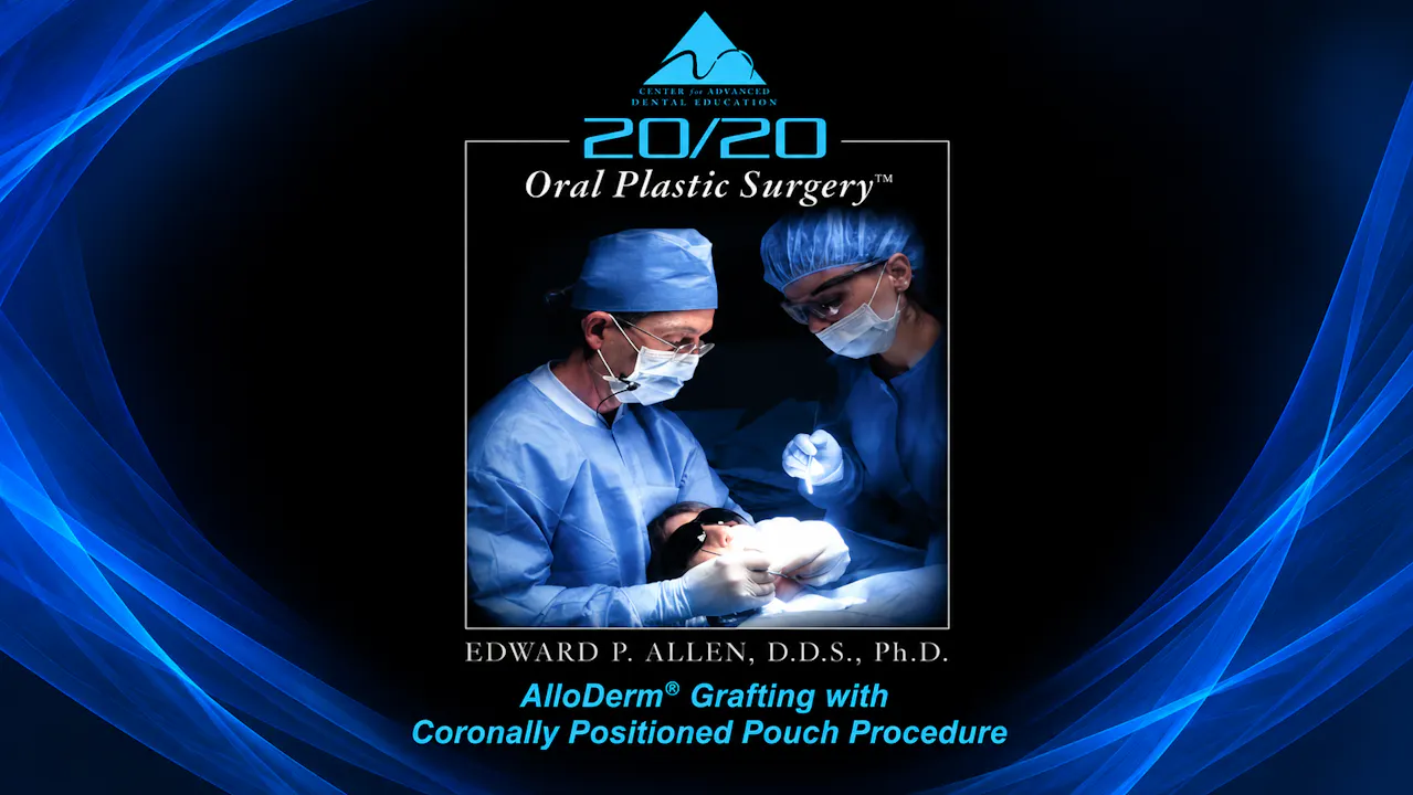 4 Coronally Positioned Pouch Procedure
