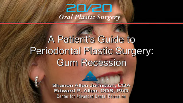 T3 A Patient's Guide to Gum Recession