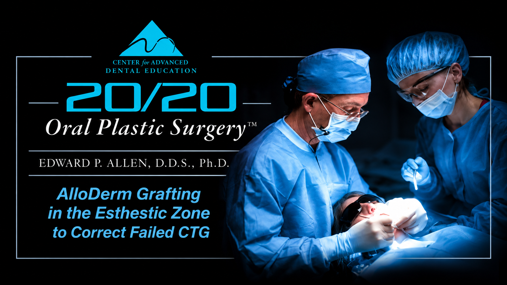 1 Esthetic Zone ADM Grafting to Correct Failed CTG