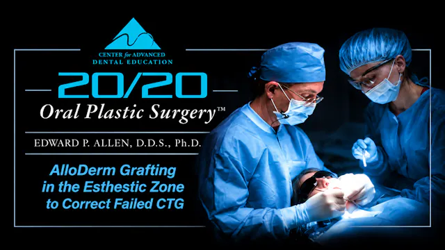 1 Esthetic Zone ADM Grafting to Correct Failed CTG