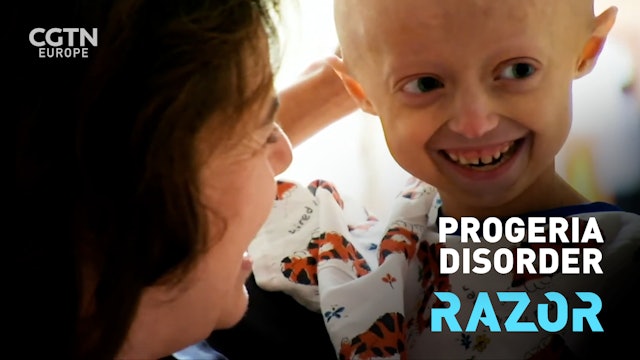 Progeria disorder #RAZOR