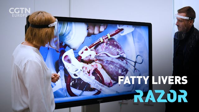 #RAZOR: Fighting the fatty liver crisis 