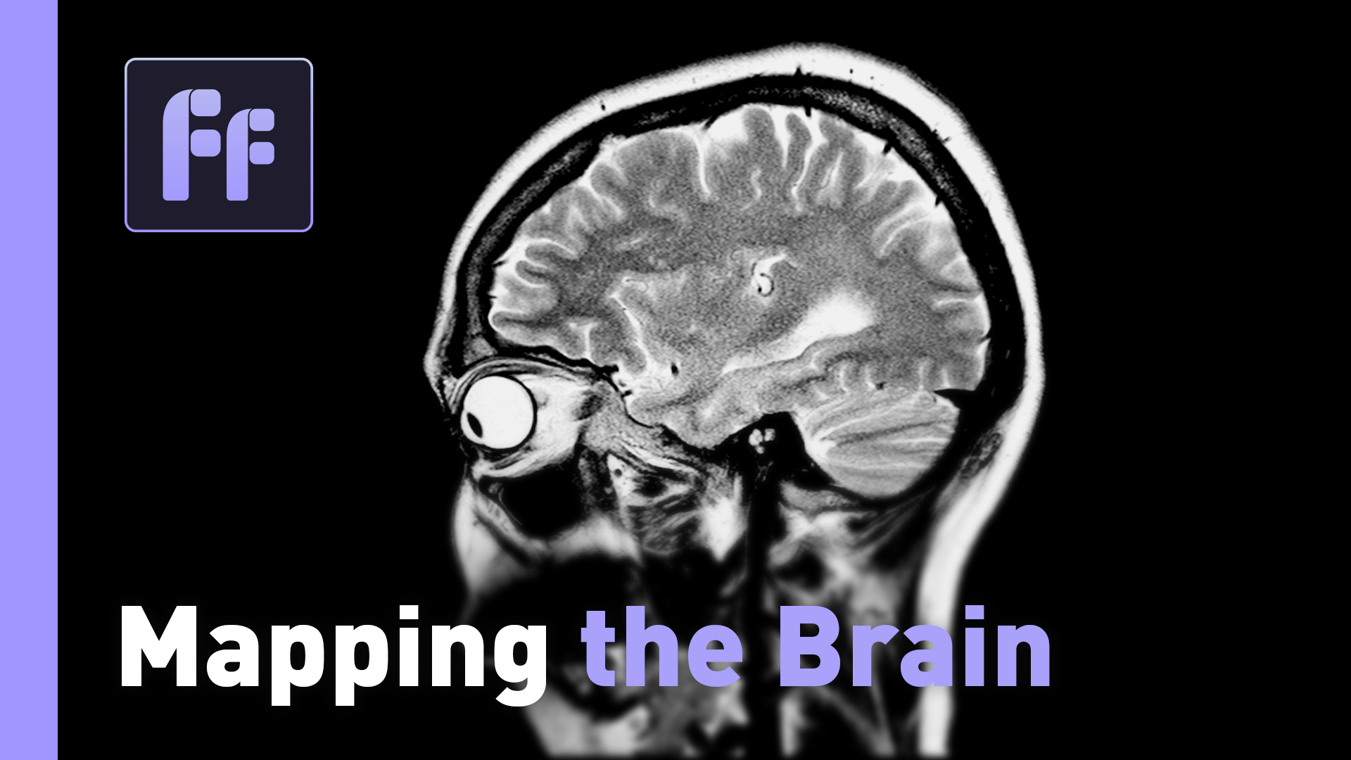 Full Frame: Mapping the Brain