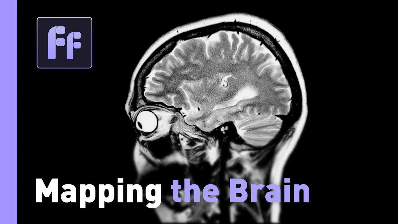 Full Frame: Mapping the Brain - Full Frame - Watch CGTN Now
