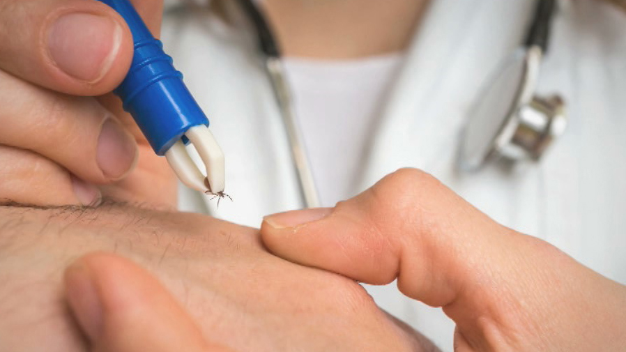 Lyme disease on the rise across US