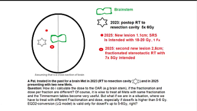 05/26/2025 - Dr. Zabi Wardak - Radiation Oncology - CNS