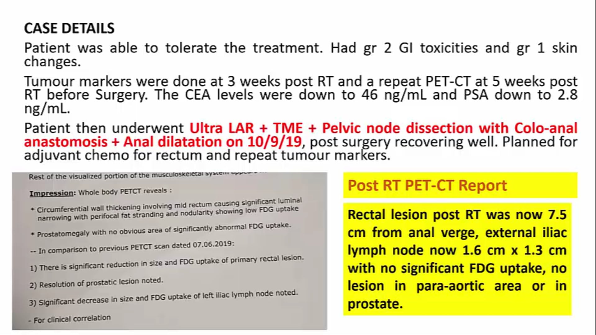 09/19/19 - Dr. Ashutosh Mukherji - Radiation Oncology - GI India