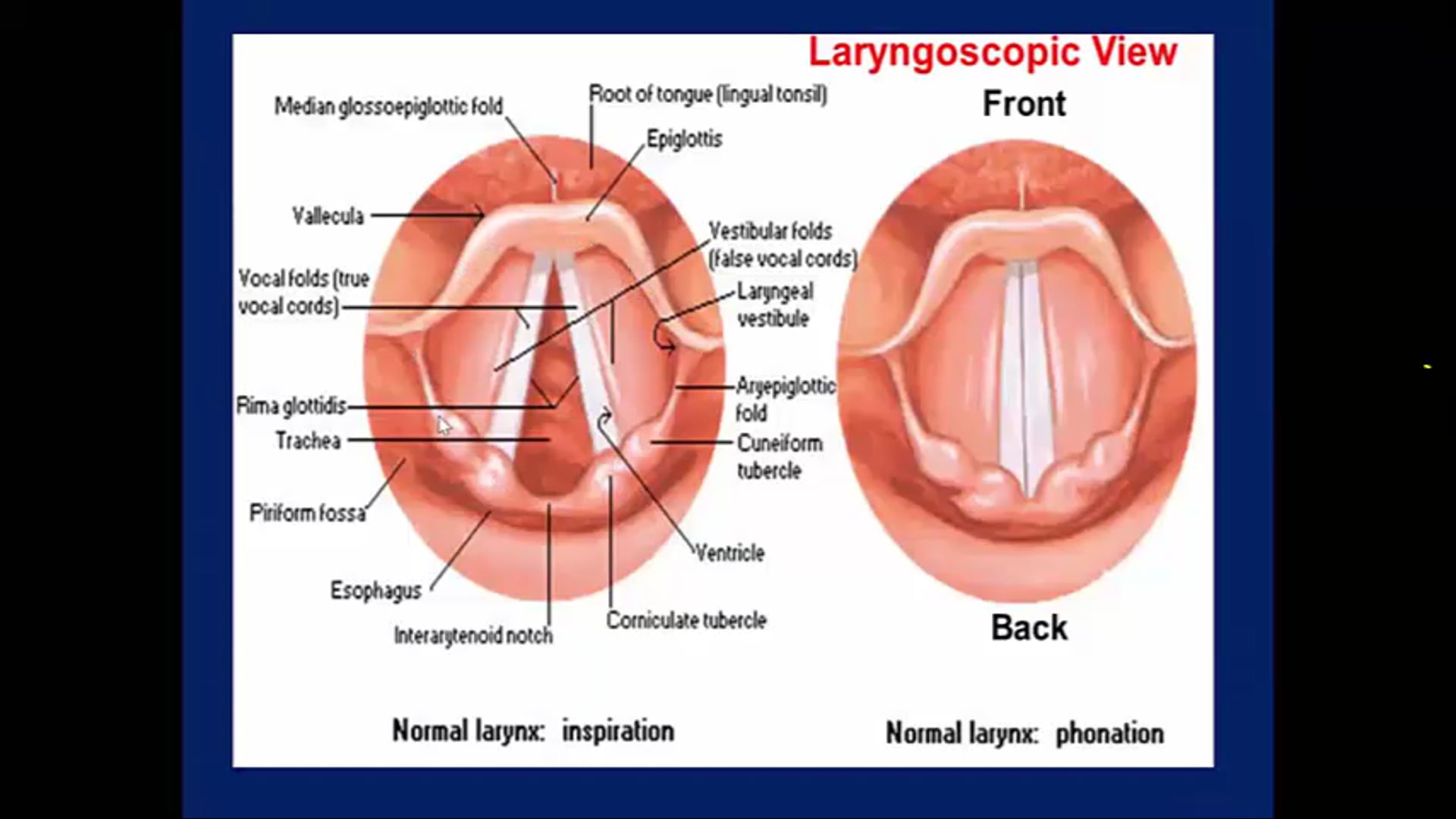 07/11/19 - Dr. Cessal Kainickal - Radiation Oncology - Head and Neck India