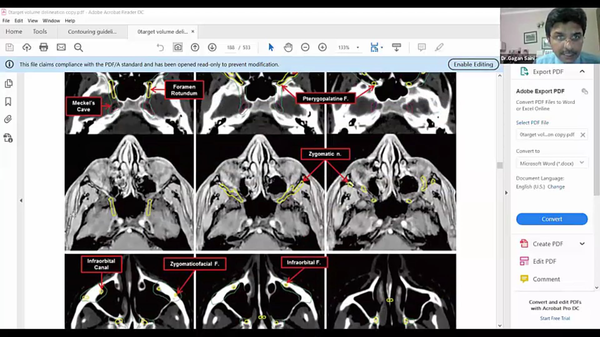 04/04/19 - Dr. Gagan Saini - Radiation Oncology - Head and Neck India