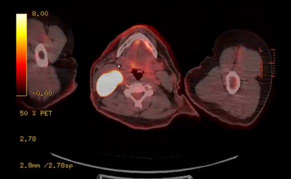04/21/2025 - Dr. Chirayu Patel - Radi...