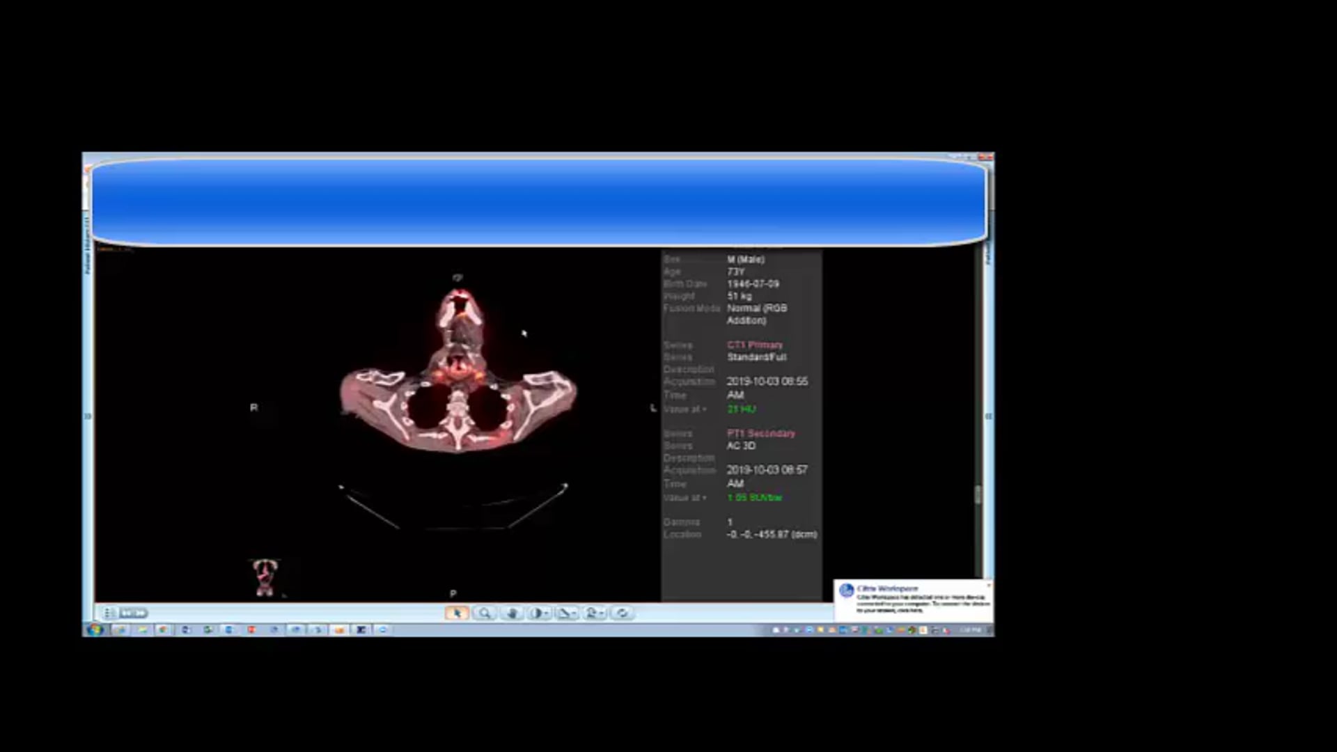 10/15/19 - Dr. Kenneth Hu - Radiation Oncology - Head and Neck US