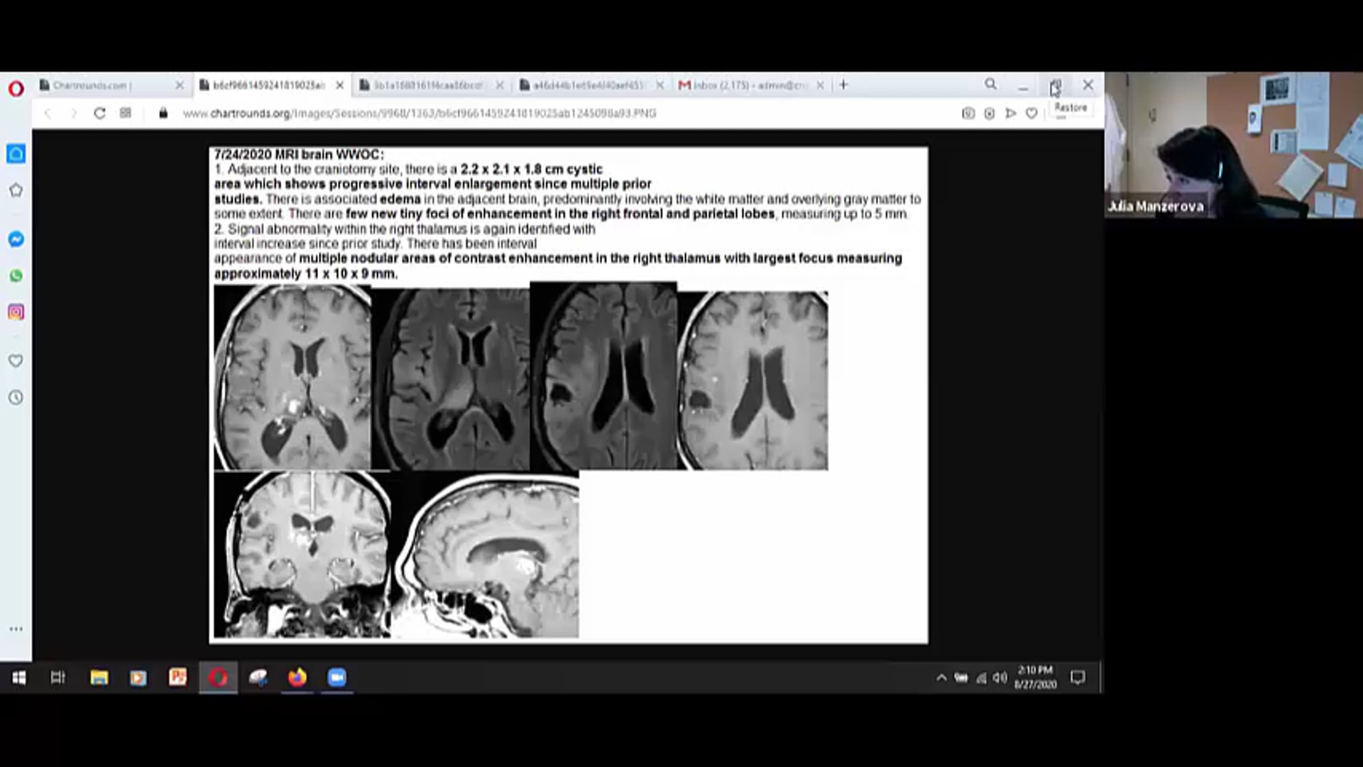 08/27/20 - Dr. John Suh - Radiation Oncology - CNS US