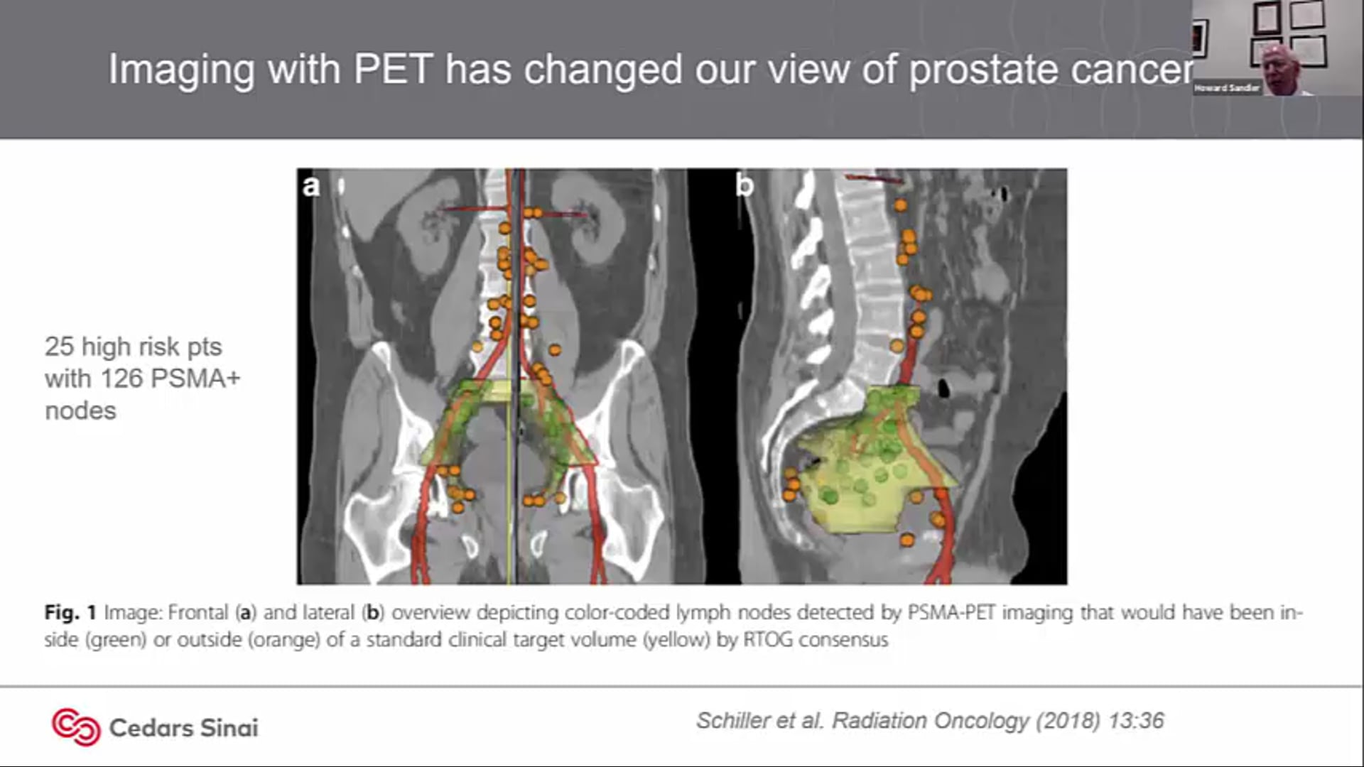 06/09/20 - Dr. Howard Sandler - Radiation Oncology - GU US