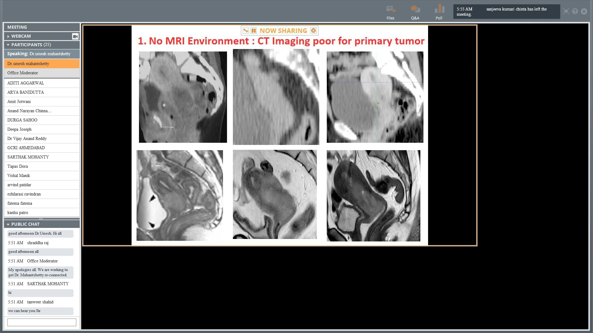 11/23/17 - Dr. Umesh Mahantshetty - Radiation Oncology - GYN India
