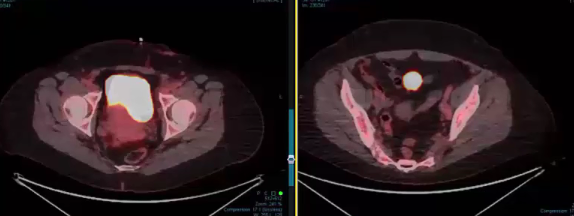 09/19/2024 - Dr. Christine Fisher - Radiation Oncology - GYN