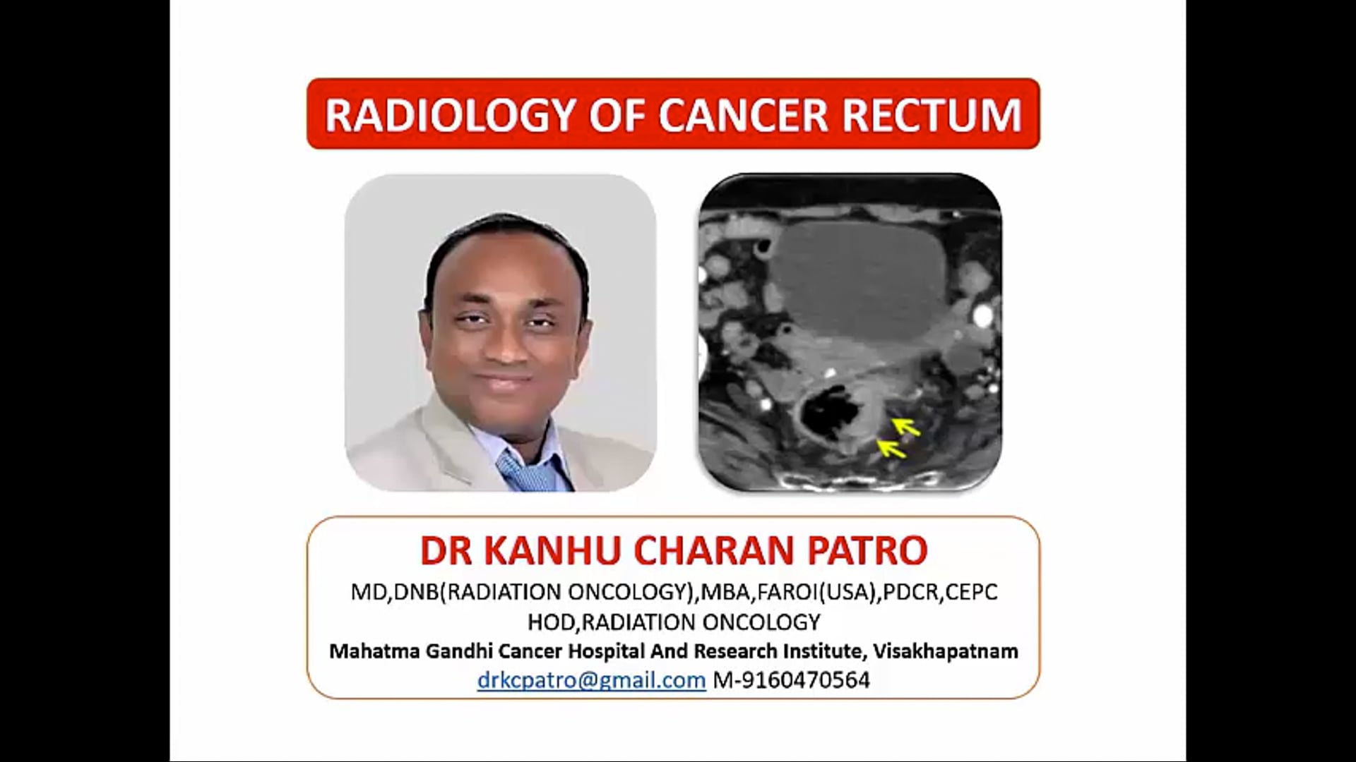 09/05/2024 -Dr. Kanhu Charan Patro - Radiation Oncology - India GI