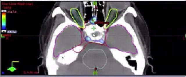 12/29/2025 - Dr. David Sher - Radiati...