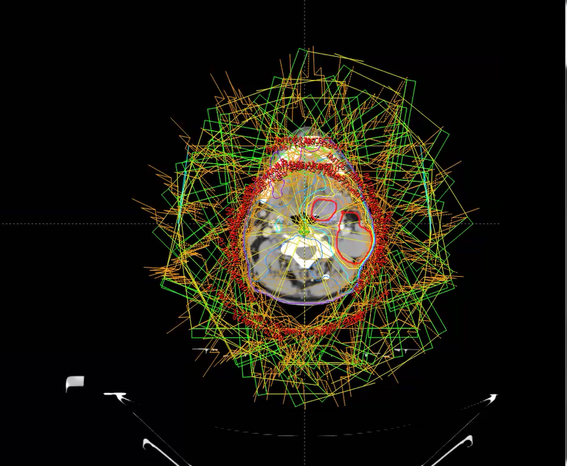 01/29/2024 - Dr. David Sher - Radiation Oncology - Head & Neck