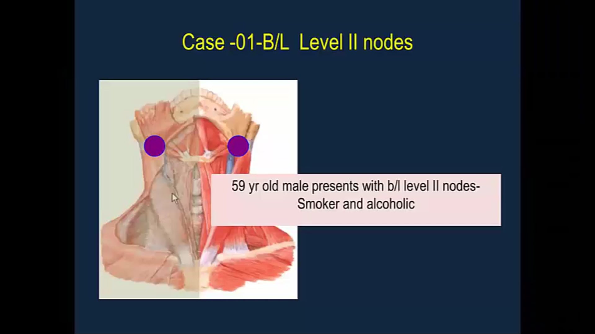 09/12/19 - Dr. Cessal Kainickal - Radiation Oncology - Head and Neck India