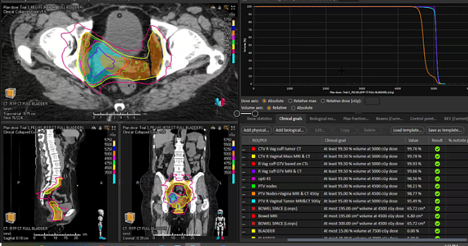05/16/2024 - Dr. Christine Fisher - Radiation Oncology - GYN